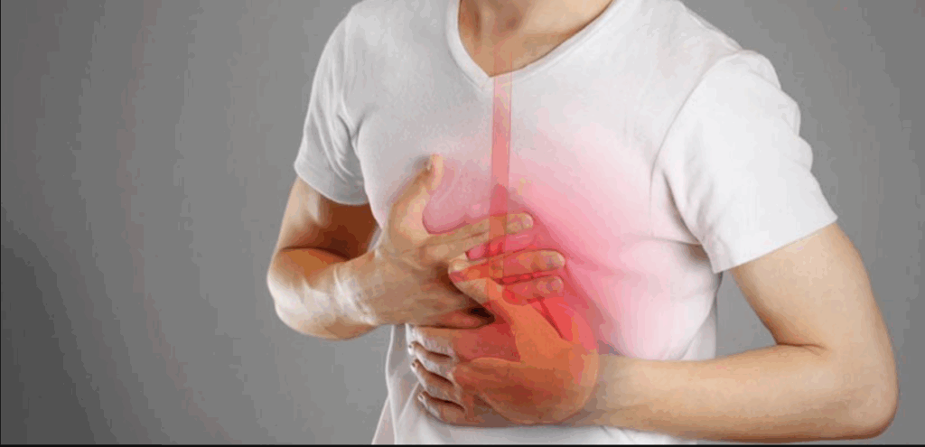 Pepto-Bismol for Heartburn: A Complete Guide to Relief heartburn