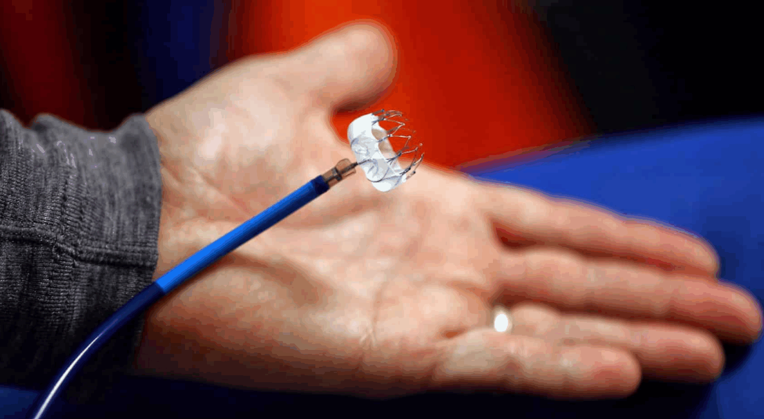 understanding the watchman device cost