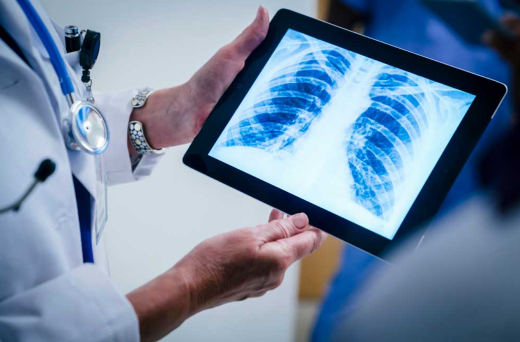 what does abnormal mean on an xray