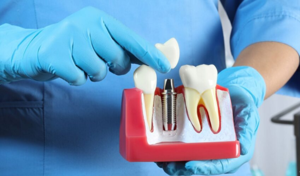 what is a dental crown